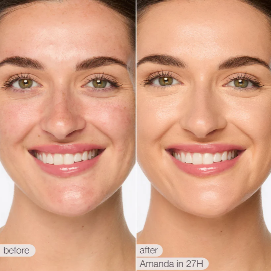 Shape Tape Creamy Concealer - Venus Cult