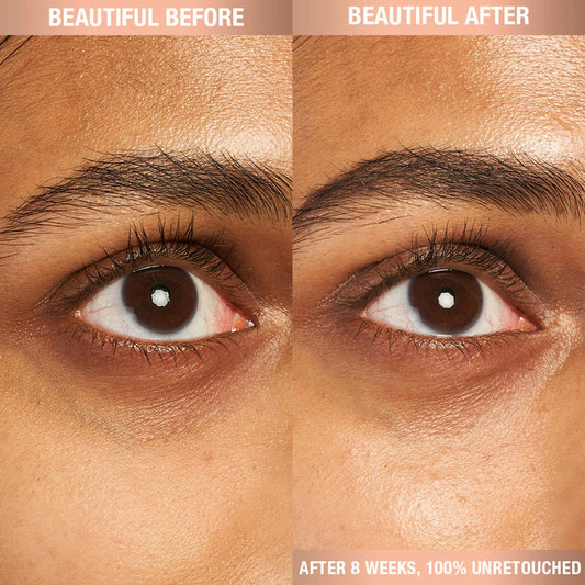 Charlotte’s Magic Eye Cream with Retinol - Venus Cult