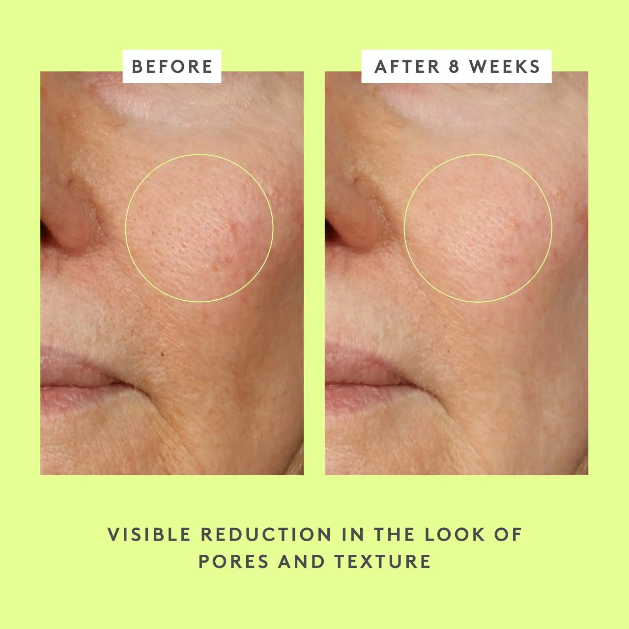 T.L.C. Framboos™ Glycolic Resurfacing Night Serum - Venus Cult