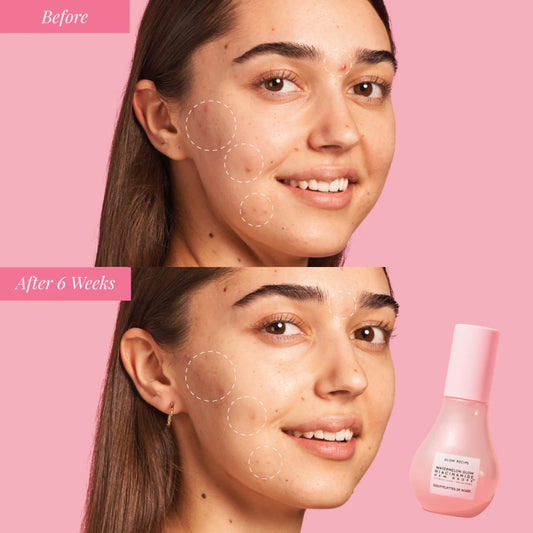 Watermelon Glow Niacinamide Dew Drops Serum - Venus Cult